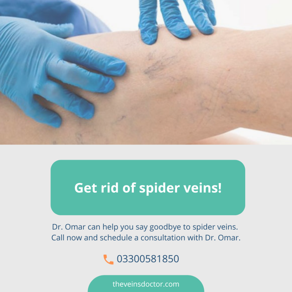 Varicose Veins The Best Treatment Options In Bristol